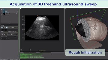 Ultrasound imaging with the Cephasonics platform