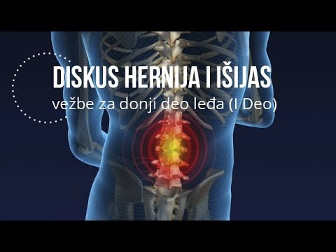 Exercises for the lower back - spinal disc herniation and sciatica - 1st part