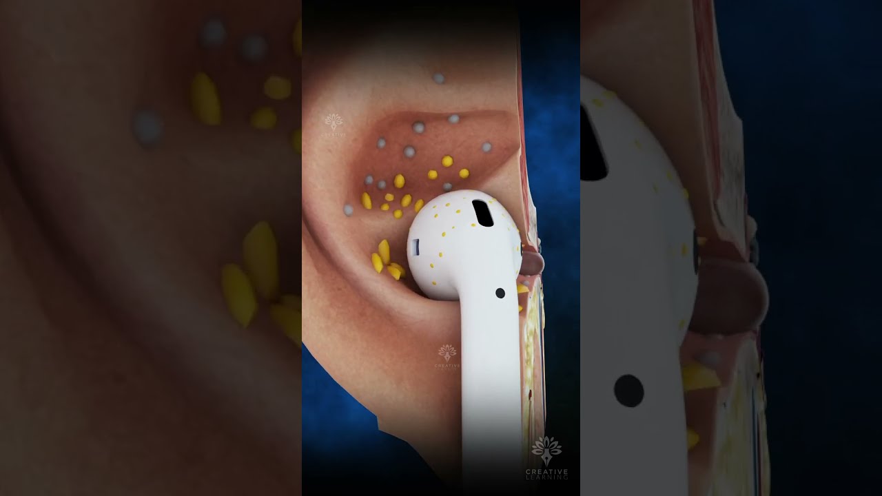 Why Your Earbuds Are Dirty Earinfection Earwax Shorts Viral Creativelearning3d