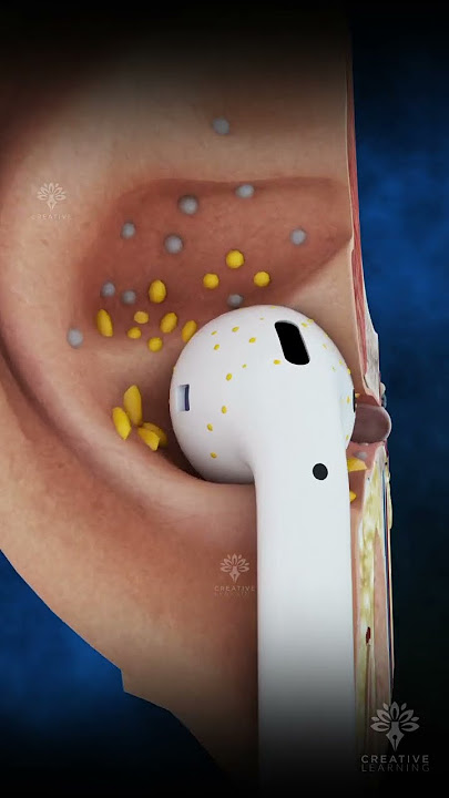 Why Your Earbuds Are Dirty #earinfection #earwax #shorts #viral -creativelearning3d