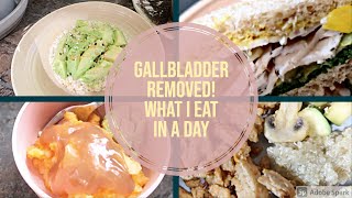 What can I eat after gallbladder removal | No gallbladder diet | low fat diet | gallbladder removal