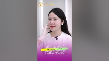 Căng chỉ Collagen Xóa nhăn rãnh cười - Viện Thẩm Mỹ Yến Nhi