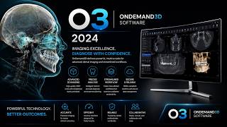 OnDemand3D Dental || 2024 || Build 1.0.11.1007.030824