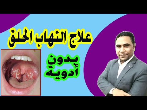 اسرع و افضل طريقه للتخلص من التهاب الحلق او احتقان الحلق بدون ادوية