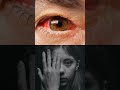 eye donation explained #viral #shortvideo