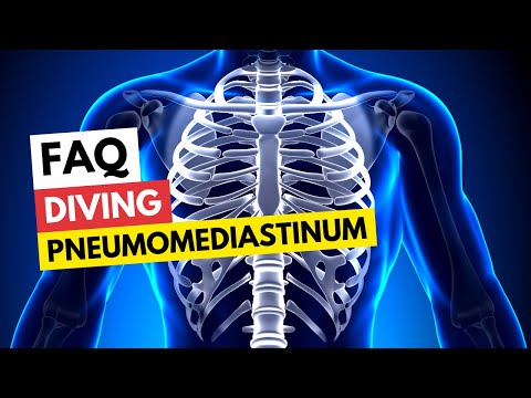 FAQ Diving & Pneumomediastinum