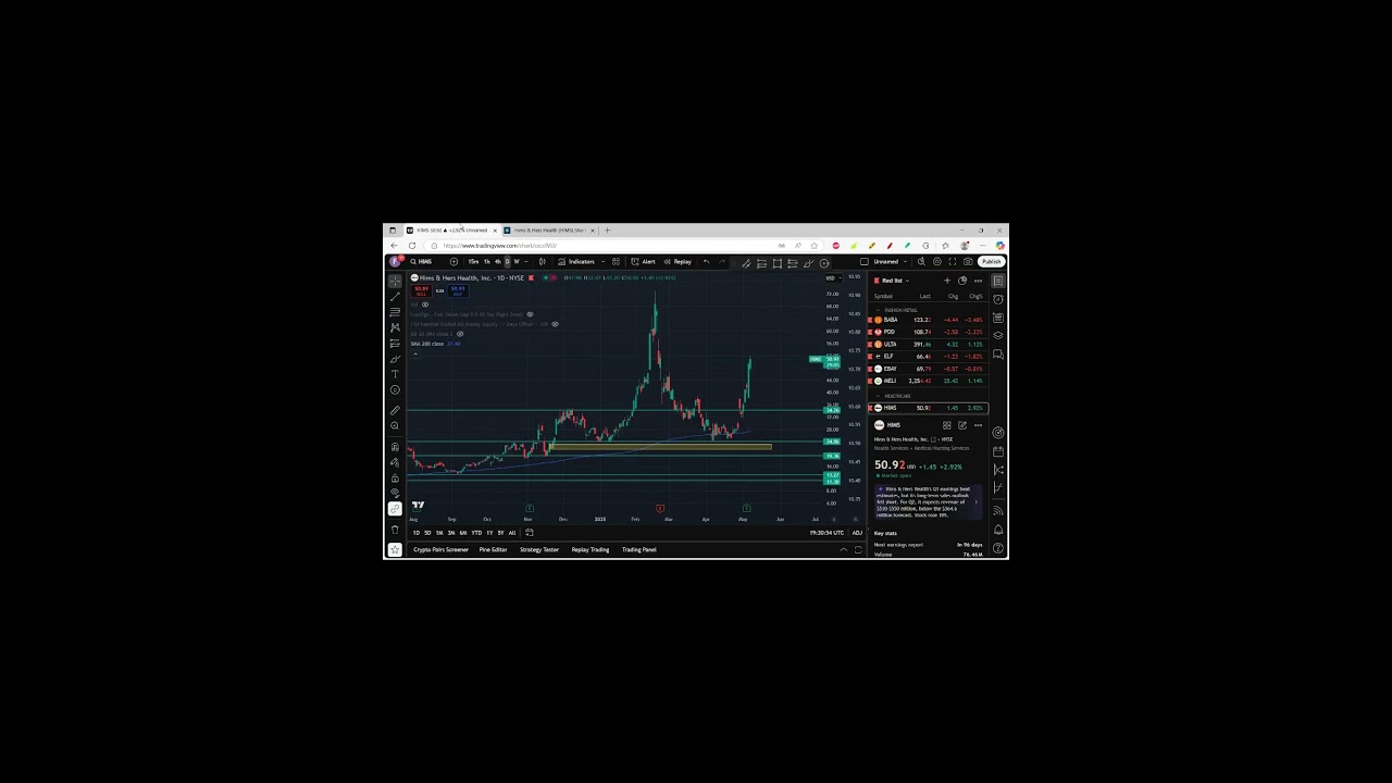 Hims stock up 30%!   update 