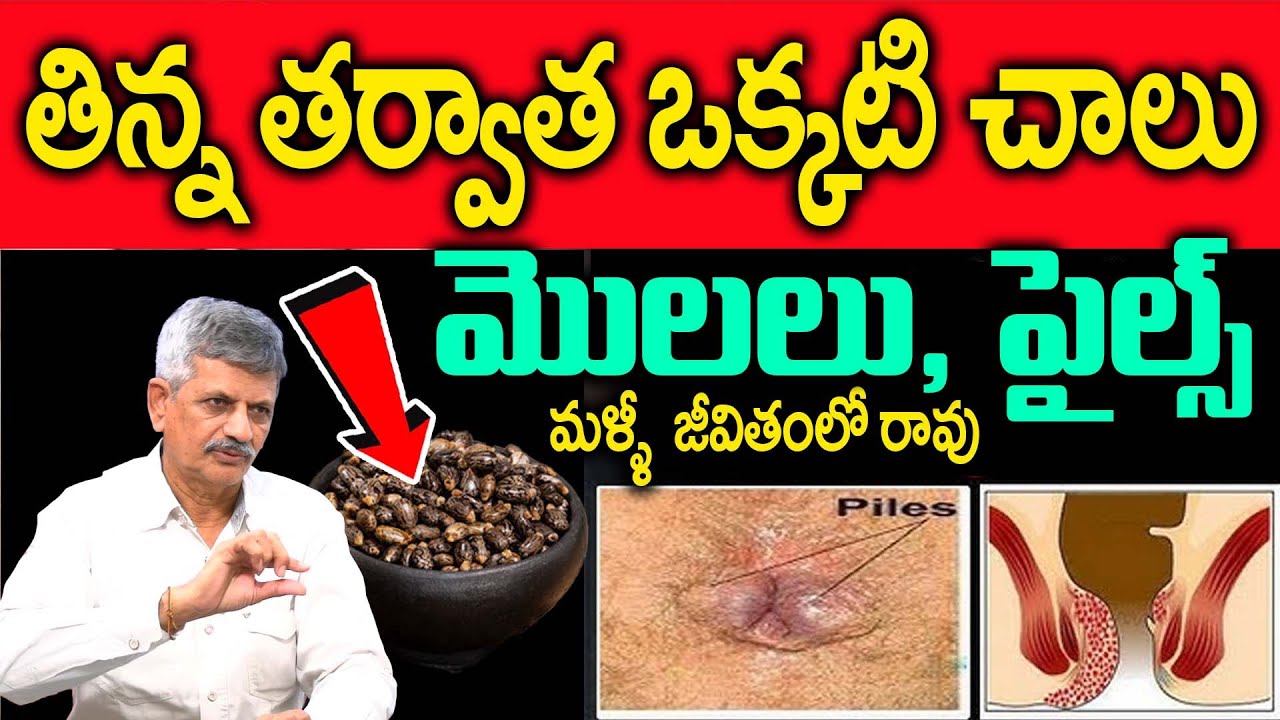 మజ్జిగలో కలిపి ఒక్కటి చాలు మొలలుశాశ్వతంగా మాయం | eliminate the warts forever | Dr Anjaneya Raju