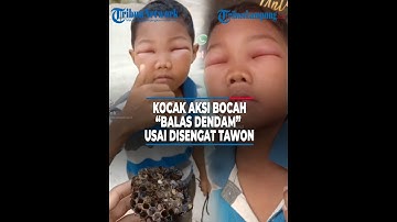 AKSI BALAS DENDAM BOCAH USAI DISENGAT LEBAH MALAH BUAT NGAKAK