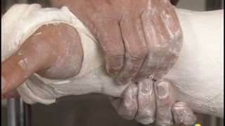 Applying a basic forearm circular cast screenshot 5