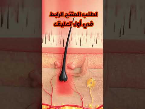 أفضل زيت لتساقط الشعر فيتاليتي