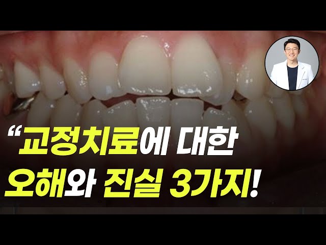 치아교정 치료에 대한 오해와 진실 3가지!