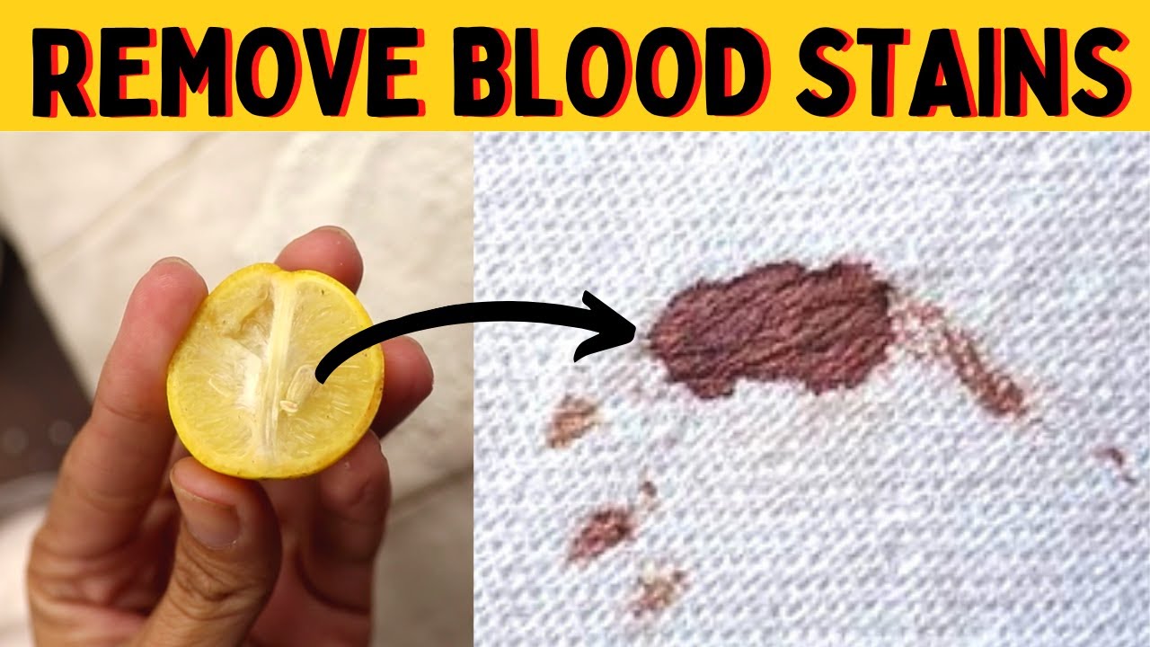 How To Remove Old Dried Blood Stains From Mattress Without Washing