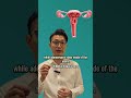 Adenomyosis vs Endometriosis, spot the difference