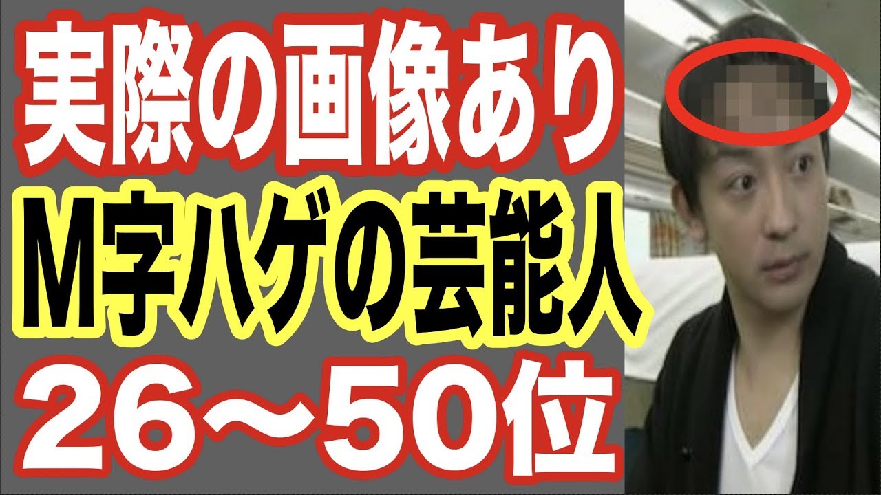 画像有 M字ハゲの芸能人26 50位 イケメンの髪型も薄毛でおでこが 世界の果てまで芸能裏情報チャンネル Youtube