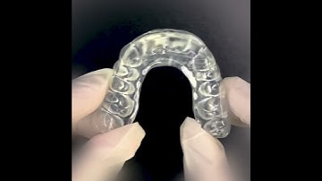 Night Guard with Digital Impression