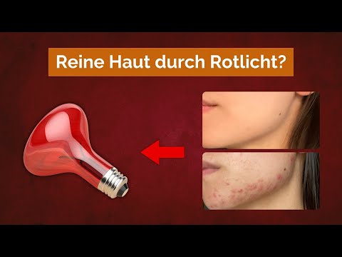 Rotlicht: Die Geheimwaffe gegen Akne und Unreinheiten?