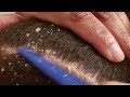 ASMR Dandruff Scratching Hair Combing Flake Removal