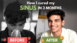 7-Year Old Sinus Problem Gone in 3 Months | Sinus Treatment at Home
