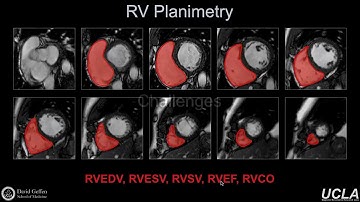 ISMRM MR Academy -Functional Analysis