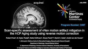 Assessment of prospective motion correction in the HCP aging study (Abstract 0467)