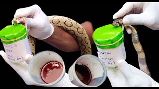 Cobra venom and Russell's viper venom to human blood - snakes guardian# snake guardian