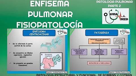 ¿Cuál es la causa principal del enfisema?