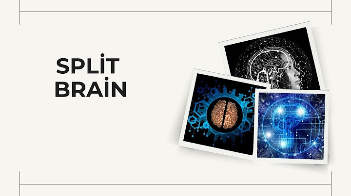 Split Brain: Unveiling the Mysteries of Consciousness