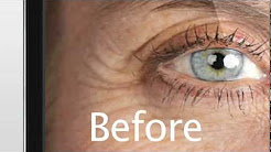 Remove Wrinkles and Blemishes with this iPhone App