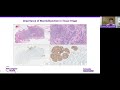 Navigating Breast Cancer Care | Part 1: Diagnosis