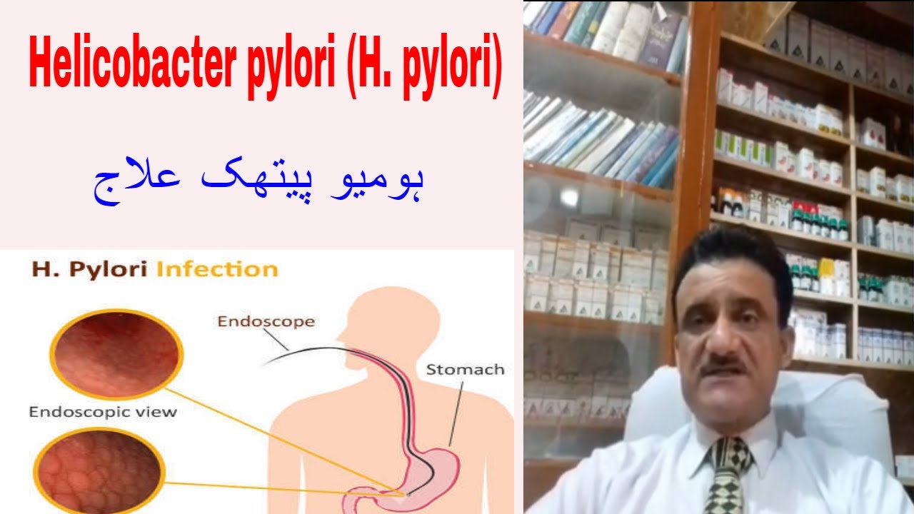 (H. Pylori) Infection Homeopathic treatment By Dr Asad Naqvi YouTube