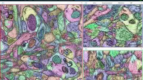 webKnossos: Community Dataset Gallery & Navigating Through Data