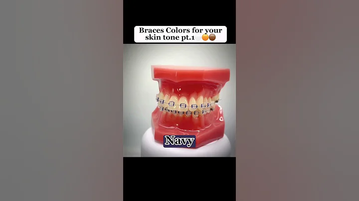 Braces color to match your skin🤩 #shorts