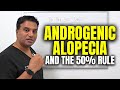 Androgenic Alopecia and The 50% Rule