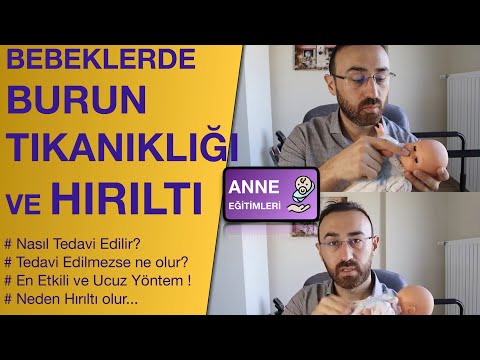 Video: Çekiç Burun Nasıl Engellenir: 12 Adım (Resimlerle)