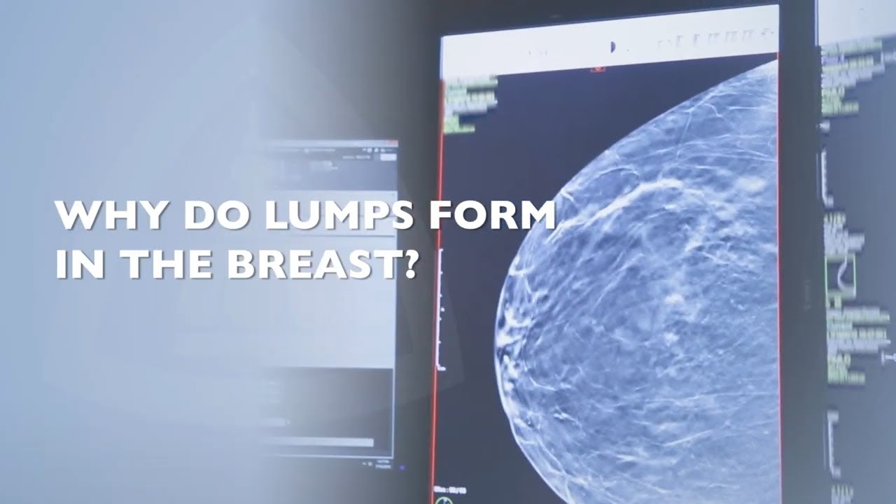 What To Do When You Find a Lump in Your Breast? - YouTube