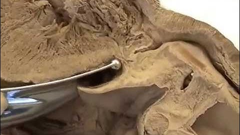 Valleculoscopy using a curved direct laryngoscope blade