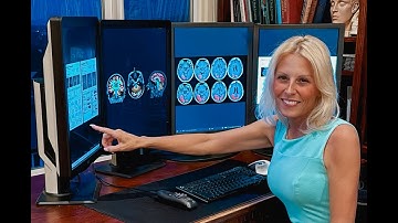 Dr. Suzie Bash on Michael Bolton’s Glioblastoma: How NeuroQuant Brain Tumor Is Advancing Care