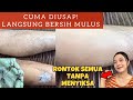 BEBAS BULU SELAMANYA! RONTOK SEMUA! BERSIH MULUS KULIT JADI CERAH! MENGHILANGKAN BULU TANPA MENYIKSA