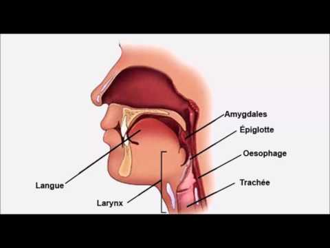 Vidéo: Épiglottite: Causes, Symptômes Et Diagnostic