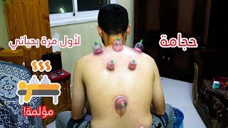 عملت حجامة لأول مرة بحياتي || شو حسيت بعدها؟!