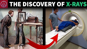 How Were X Rays Discovered by  Accident?
