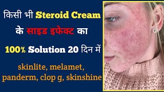 Steroid Cream के साइड इफेक्ट्स दूर करके  चेहरा साफ और गोरा बनाएं  |  Remove Redness Side effect