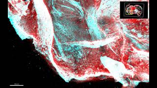 Mouse Brain - Coronal Section