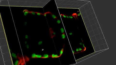 How to measure distances in your 3D microscopy data? - Tutorial