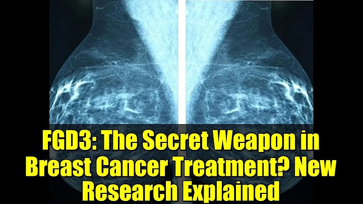 FGD3: The Secret Weapon in Breast Cancer Treatment? New Research Explained