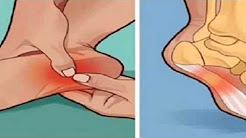 Sientes Dolor En El Talón Del Pie Cuando Te Levantas En Las Mañanas Esto Es Lo Que Debes Saber, ¿Dolor de talón? Te contamos posibles causas, DOLOR EN EL TALÓN, ¿Tiene Dolor En El Talón Del Pie Al Levantarse?. Te Diré La Verdadera Razón, Y Como Remediarlo