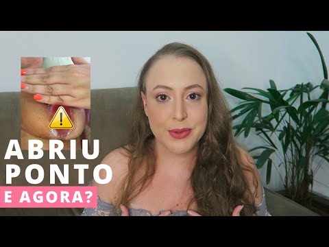 MAMOPLASTIA meu ponto abriu *RELATO COMPLETO COM FOTOS*