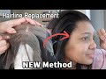 NEW Lace Front Wig Hack! Fix Your Ruined Frontal At Ease! HD Hairline Replacement| Hairvivi