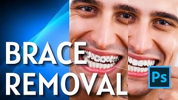 How to Remove Dental Braces in Photoshop